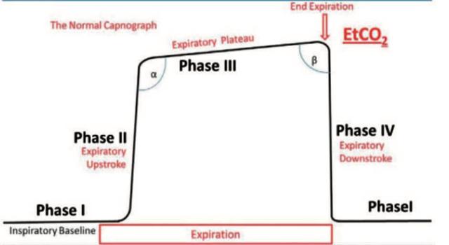 Capnography is an important tool used for CO₂ monitoring in different clinical settings.