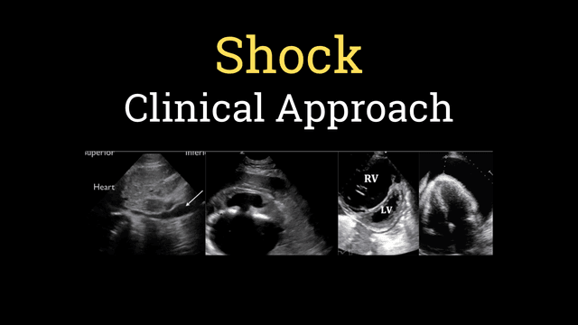 General Clinical Approach to Circulatory Shock