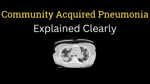 Community acquire pneumonia