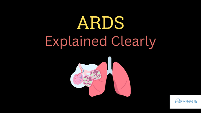 ARDS EXPLAINED CLEARLY